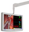 Clear Screen Protector for Radiance G2 HB 26" Surgical Monitor
